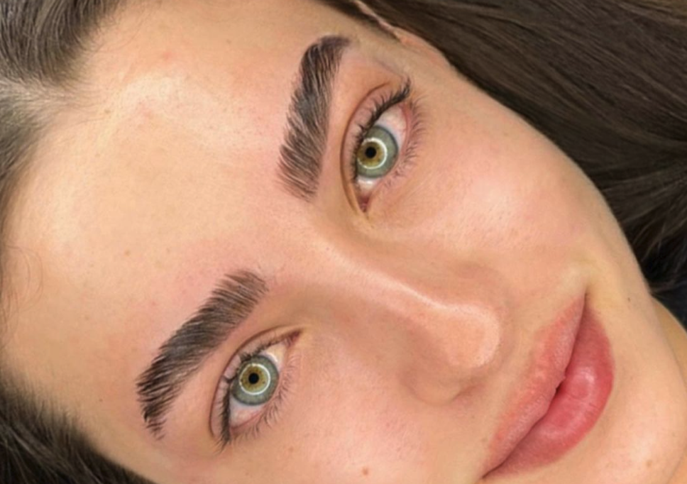 Brow Lift 5