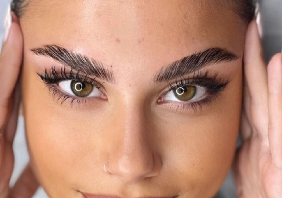 Brow Lift 3