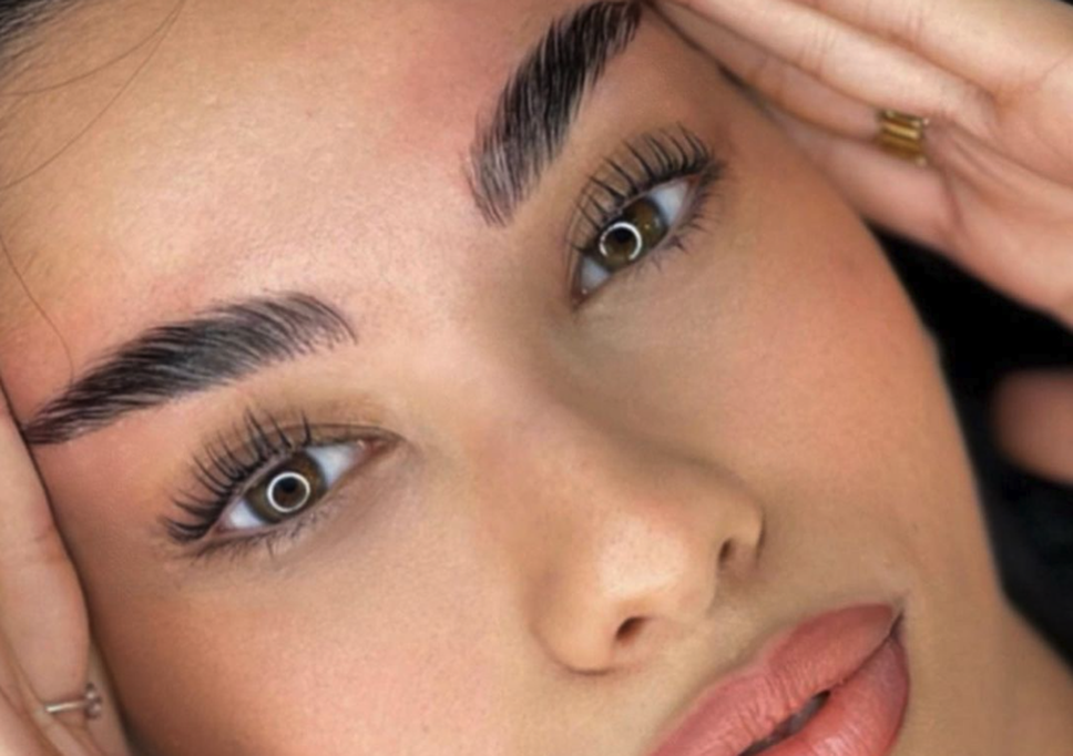 Brow Lift 2